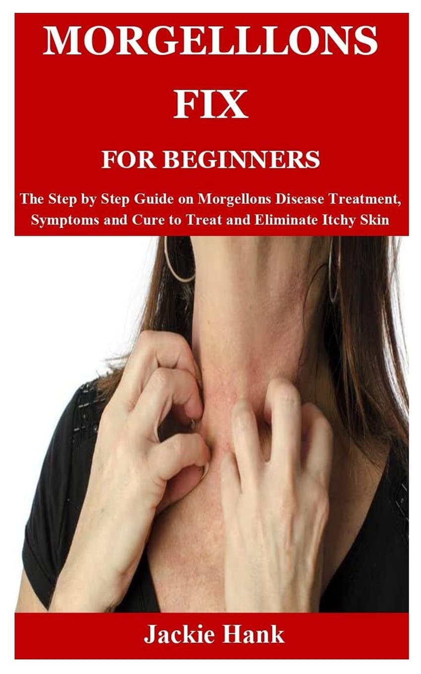 Morgelllons Fix for Beginners: The Step by Step Guide on Morgellons Disease Treatment, Symptoms and Cure to Treat and Eliminate Itchy Skin